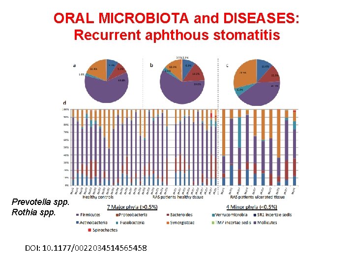 ORAL MICROBIOTA and DISEASES: Recurrent aphthous stomatitis Prevotella spp. Rothia spp. DOI: 10. 1177/0022034514565458