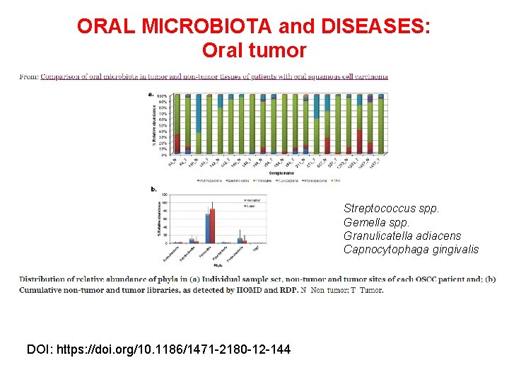 ORAL MICROBIOTA and DISEASES: Oral tumor Streptococcus spp. Gemella spp. Granulicatella adiacens Capnocytophaga gingivalis