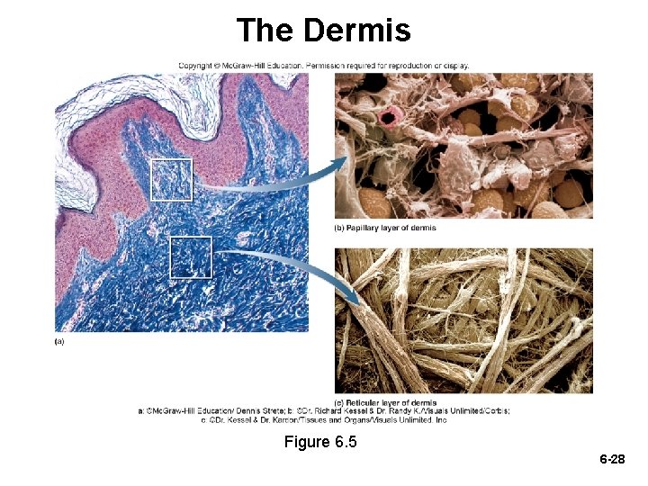 The Dermis Figure 6. 5 6 -28 The Dermis Figure 6. 5 6 -28