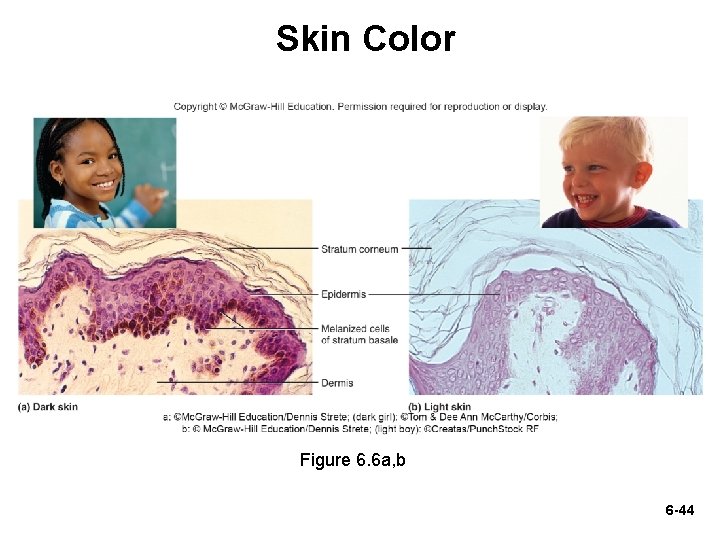 Skin Color Figure 6. 6 a, b 6 -44 Skin Color Figure 6. 6 a, b 6 -44