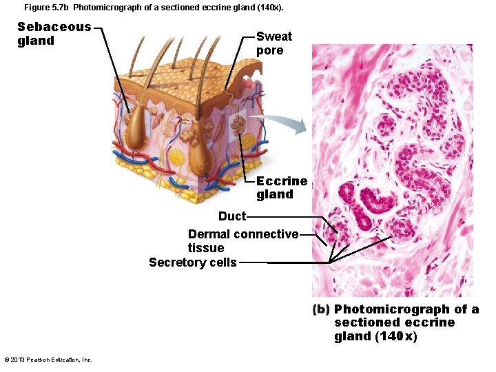 Figure 5. 7 b Photomicrograph of a sectioned eccrine gland (140 x). Sebaceous gland Figure 5. 7 b Photomicrograph of a sectioned eccrine gland (140 x). Sebaceous gland