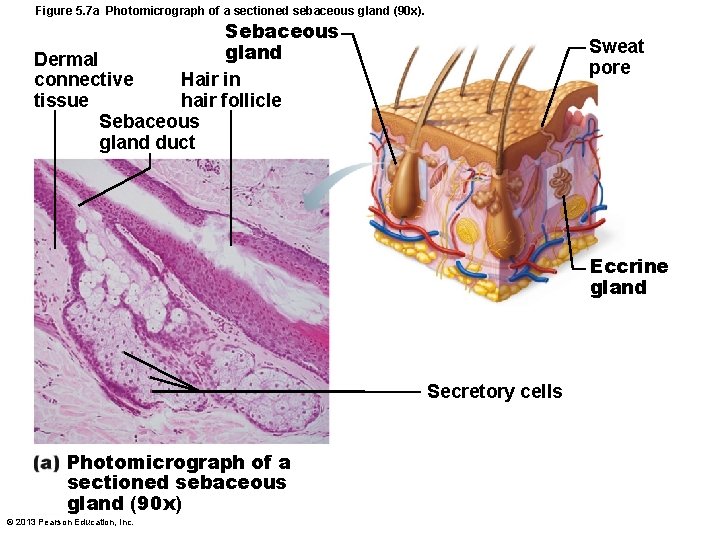 Figure 5. 7 a Photomicrograph of a sectioned sebaceous gland (90 x). Sebaceous gland Figure 5. 7 a Photomicrograph of a sectioned sebaceous gland (90 x). Sebaceous gland