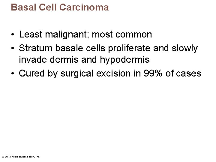 Basal Cell Carcinoma • Least malignant; most common • Stratum basale cells proliferate and Basal Cell Carcinoma • Least malignant; most common • Stratum basale cells proliferate and