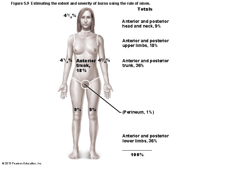 Figure 5. 9 Estimating the extent and severity of burns using the rule of Figure 5. 9 Estimating the extent and severity of burns using the rule of