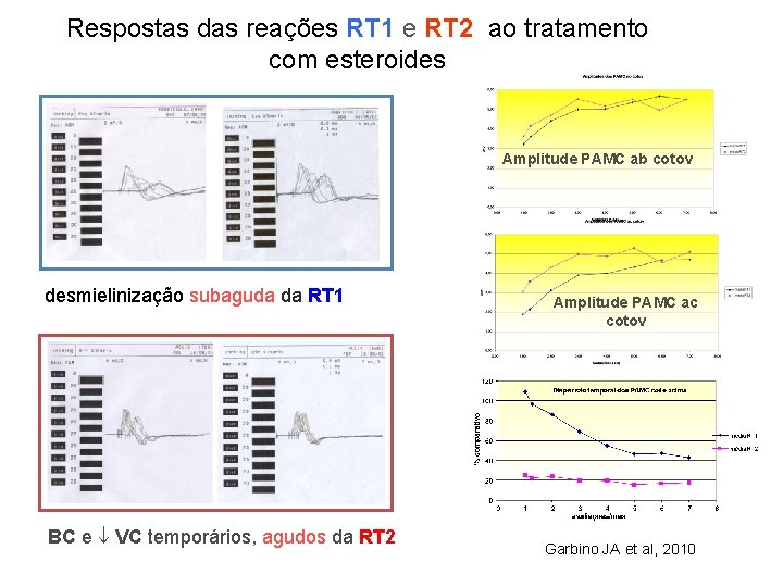 Respostas das reações RT 1 e RT 2 ao tratamento com esteroides Amplitude PAMC