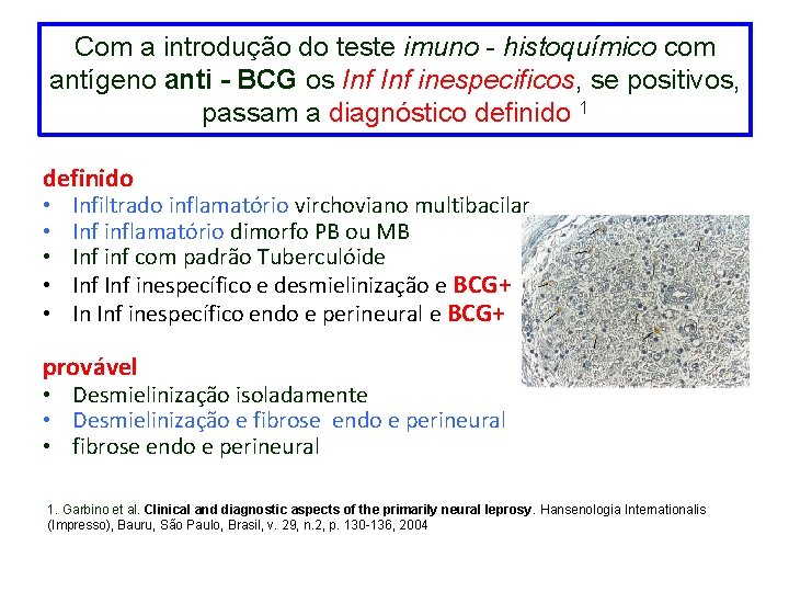 Com a introdução do teste imuno - histoquímico com antígeno anti - BCG os