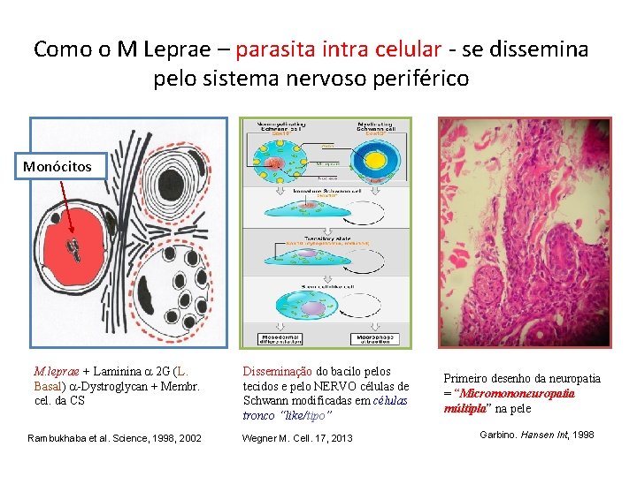 Como o M Leprae – parasita intra celular - se dissemina pelo sistema nervoso