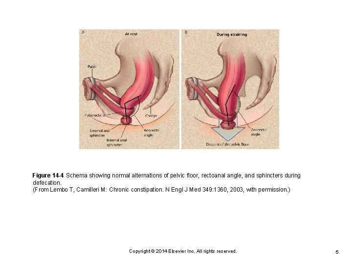Figure 14 -4 Schema showing normal alternations of pelvic floor, rectoanal angle, and sphincters