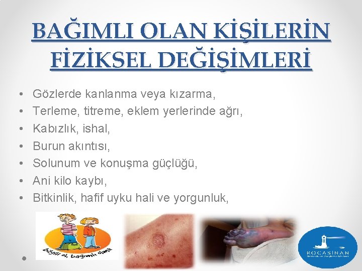 BAĞIMLI OLAN KİŞİLERİN FİZİKSEL DEĞİŞİMLERİ • • Gözlerde kanlanma veya kızarma, Terleme, titreme, eklem