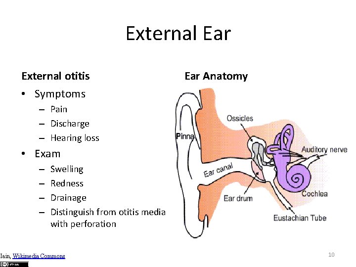 External Ear External otitis Ear Anatomy • Symptoms – Pain – Discharge – Hearing