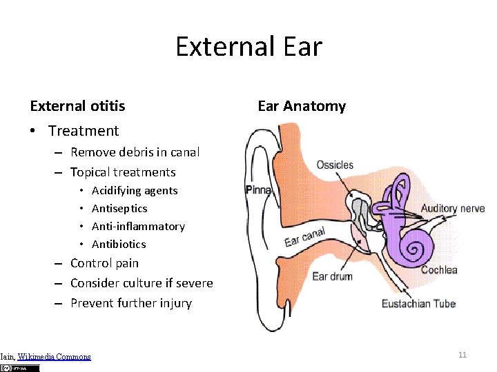 External Ear External otitis Ear Anatomy • Treatment – Remove debris in canal –