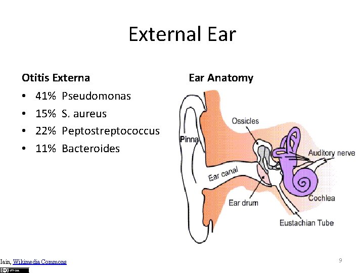 External Ear Otitis Externa • • 41% 15% 22% 11% Ear Anatomy Pseudomonas S.