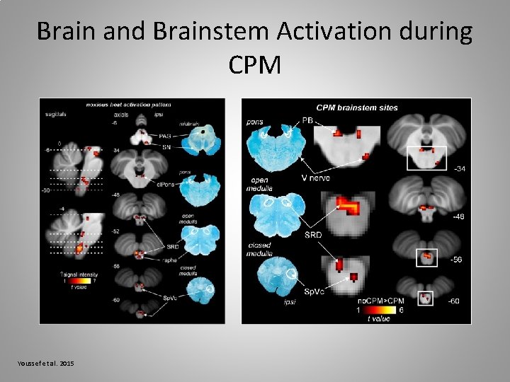 Brain and Brainstem Activation during CPM Youssef et al. 2015 