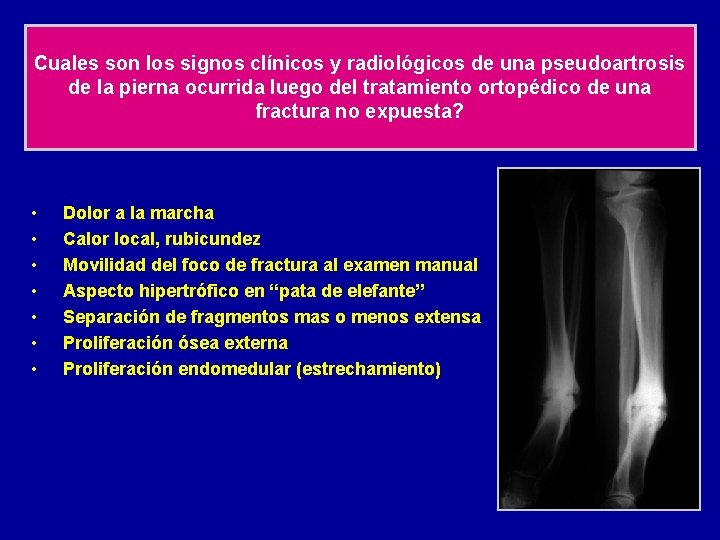 Cuales son los signos clínicos y radiológicos de una pseudoartrosis de la pierna ocurrida