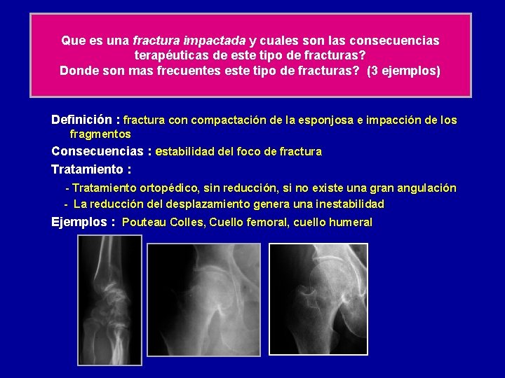 Que es una fractura impactada y cuales son las consecuencias terapéuticas de este tipo
