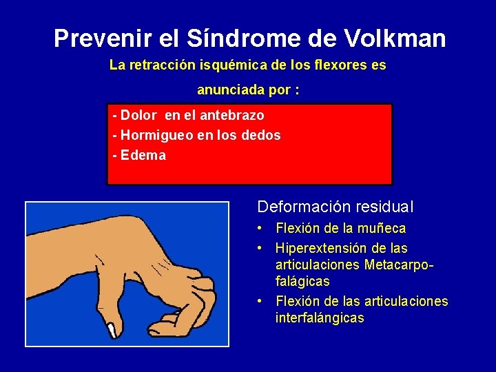 Prevenir el Síndrome de Volkman La retracción isquémica de los flexores es anunciada por