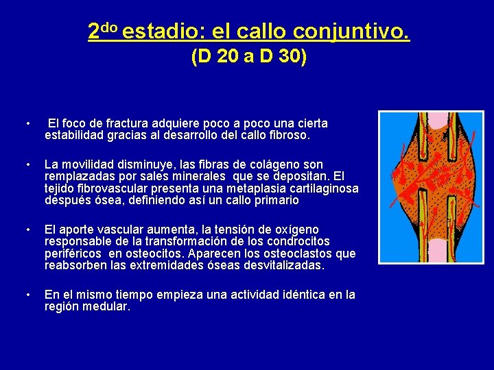 2 do estadio: el callo conjuntivo. (D 20 a D 30) • El foco