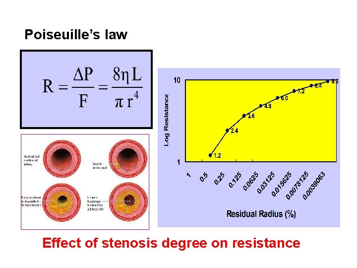 Poiseuille’s law Effect of stenosis degree on resistance Poiseuille’s law Effect of stenosis degree on resistance