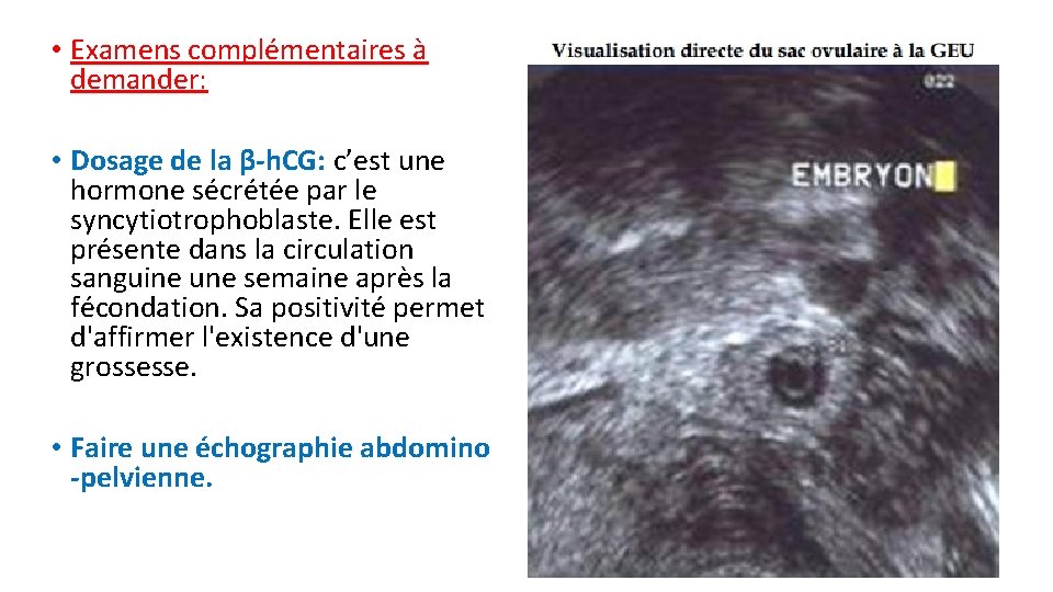  • Examens complémentaires à demander: • Dosage de la β-h. CG: c’est une
