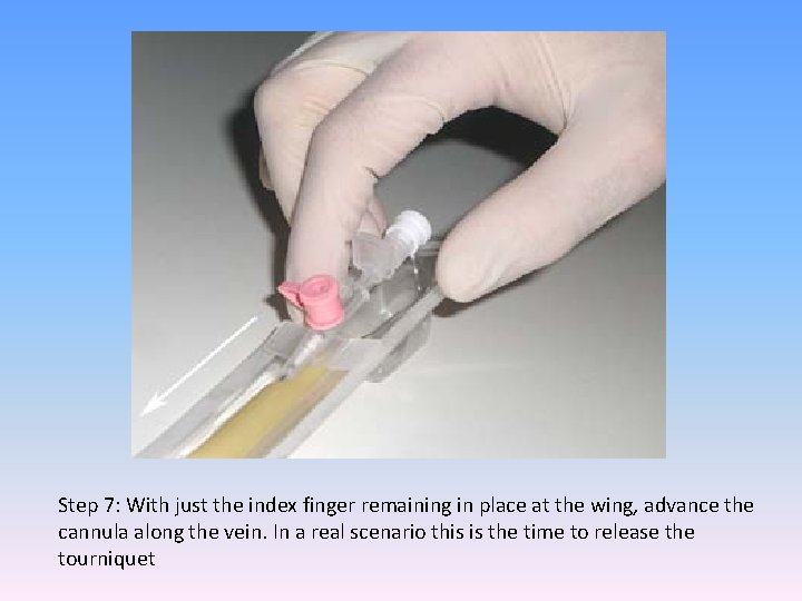 Step 7: With just the index finger remaining in place at the wing, advance