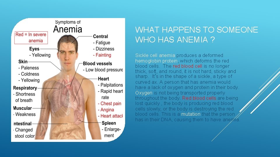 WHAT HAPPENS TO SOMEONE WHO HAS ANEMIA ? Sickle cell anemia produces a deformed