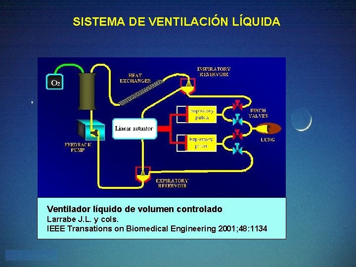 SISTEMA DE VENTILACIÓN LÍQUIDA Ventilador líquido de volumen controlado Larrabe J. L. y cols.