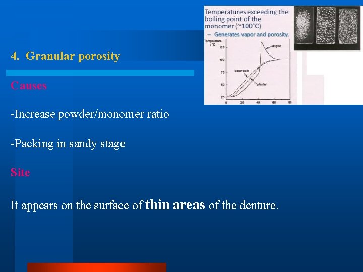 4. Granular porosity Causes -Increase powder/monomer ratio -Packing in sandy stage Site It appears