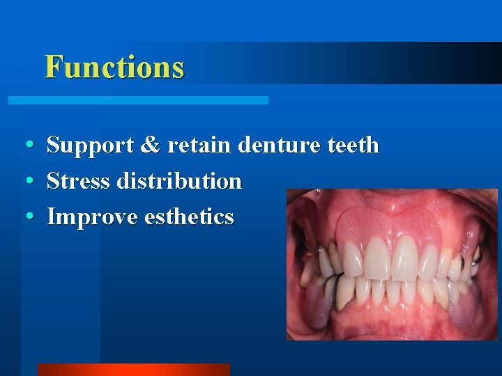 Functions • • • Support & retain denture teeth Stress distribution Improve esthetics 