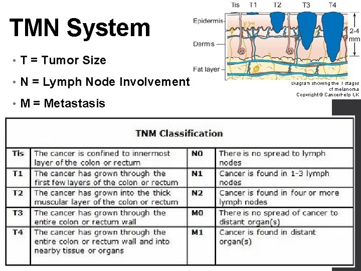 TMN System • T = Tumor Size • N = Lymph Node Involvement •