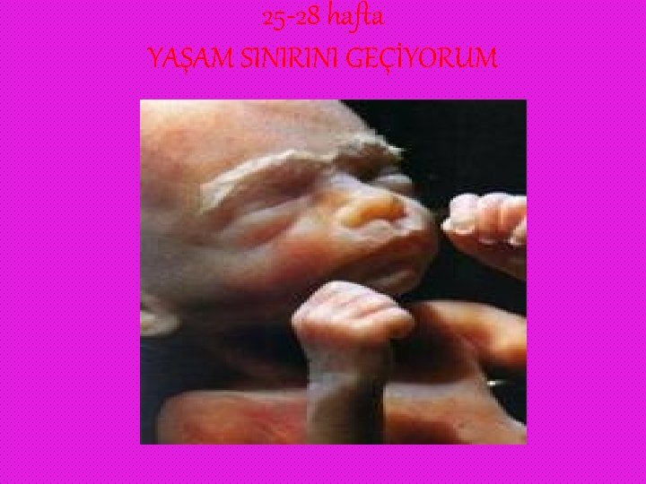 25 -28 hafta YAŞAM SINIRINI GEÇİYORUM 