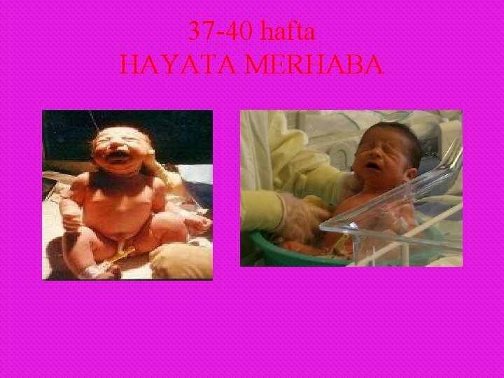 37 -40 hafta HAYATA MERHABA 