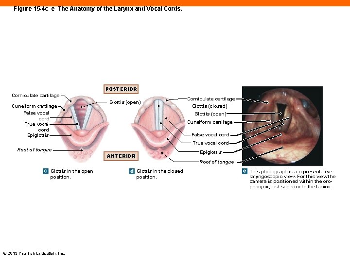 Figure 15 -4 c–e The Anatomy of the Larynx and Vocal Cords. POSTERIOR Corniculate