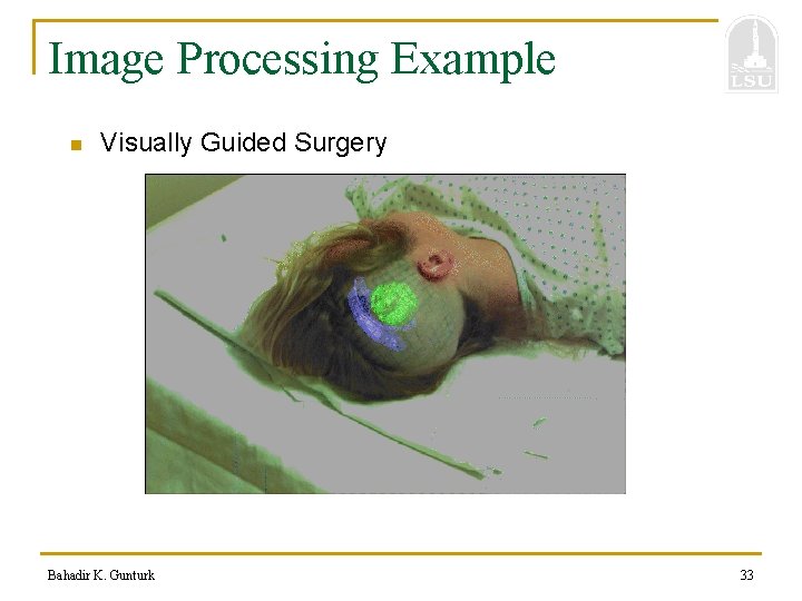 Image Processing Example n Visually Guided Surgery Bahadir K. Gunturk 33 