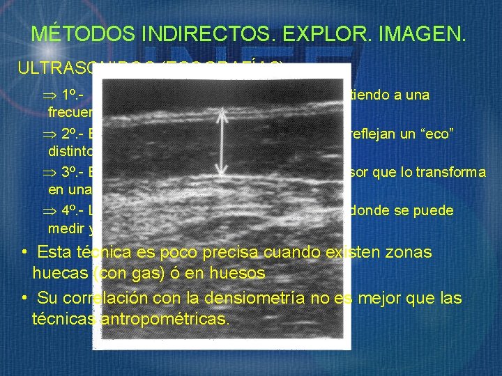 MÉTODOS INDIRECTOS. EXPLOR. IMAGEN. ULTRASONIDOS (ECOGRAFÍAS): Þ 1º. - Un transductor piezo-electrico vibra emitiendo