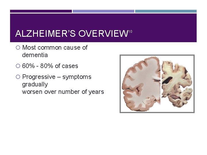 ALZHEIMER’S OVERVIEW Most common cause of dementia 60% - 80% of cases Progressive –