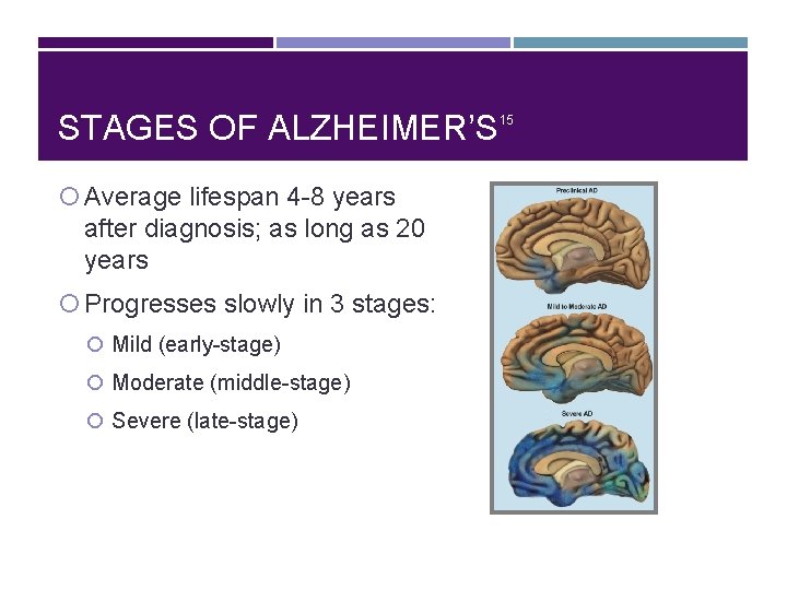 STAGES OF ALZHEIMER’S Average lifespan 4 -8 years after diagnosis; as long as 20