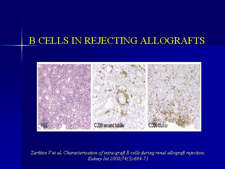 B CELLS IN REJECTING ALLOGRAFTS Zarkhin V et al. Characterization of intra-graft B cells