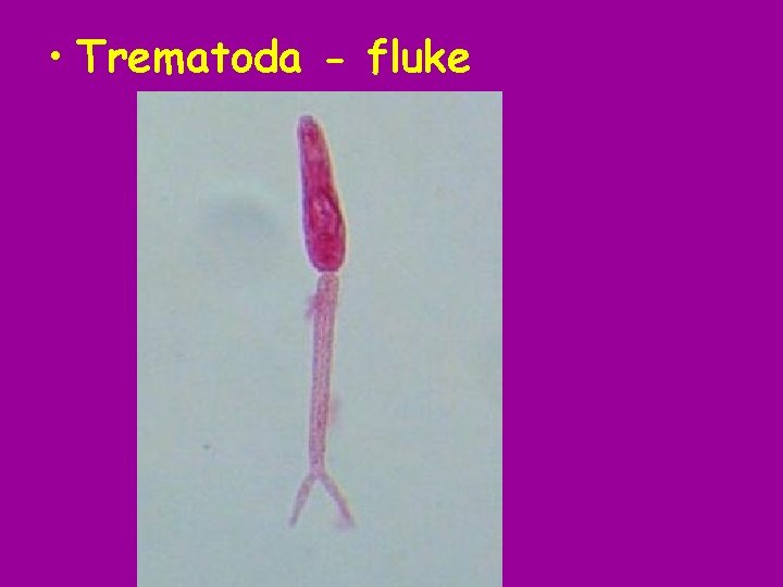  • Trematoda - fluke 