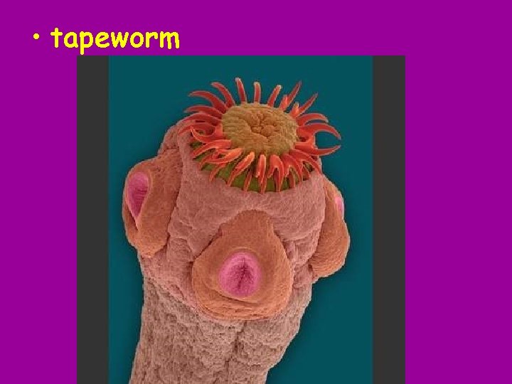  • tapeworm 