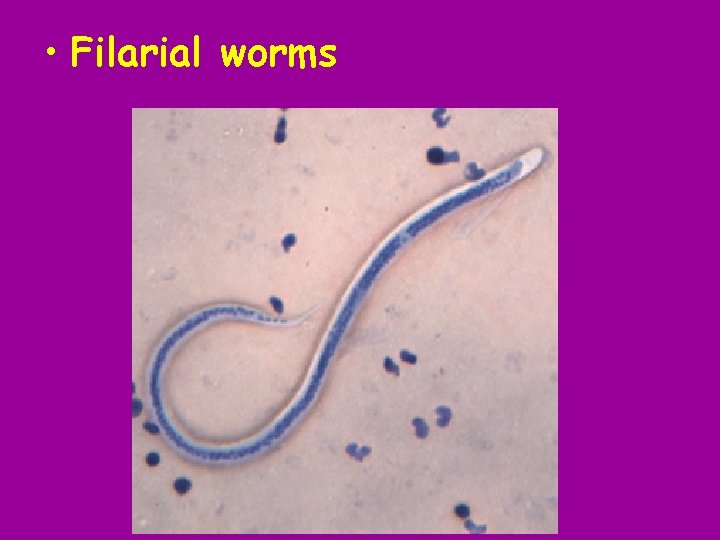  • Filarial worms 