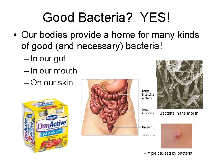 Good Bacteria? YES! • Our bodies provide a home for many kinds of good