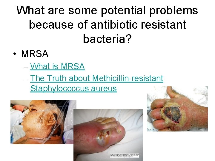 What are some potential problems because of antibiotic resistant bacteria? • MRSA – What