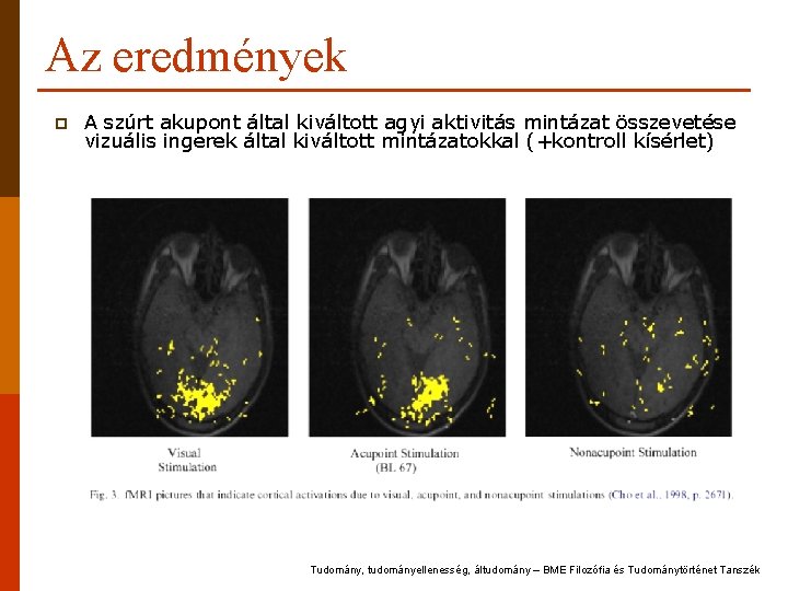 Az eredmények p A szúrt akupont által kiváltott agyi aktivitás mintázat összevetése vizuális ingerek Az eredmények p A szúrt akupont által kiváltott agyi aktivitás mintázat összevetése vizuális ingerek