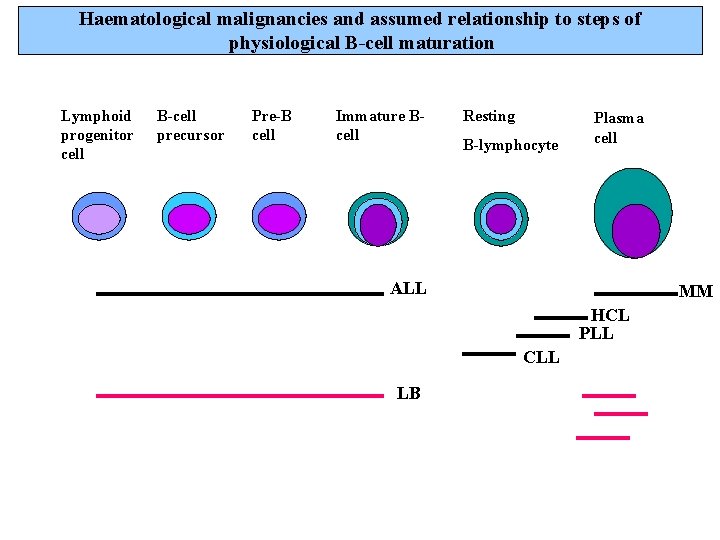 Haematological malignancies and assumed relationship to steps of physiological B-cell maturation Lymphoid progenitor cell