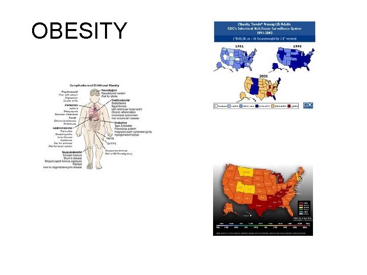 OBESITY 