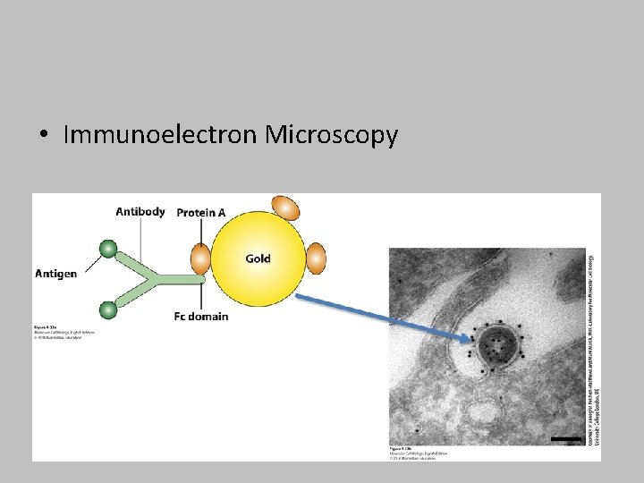  • Immunoelectron Microscopy 