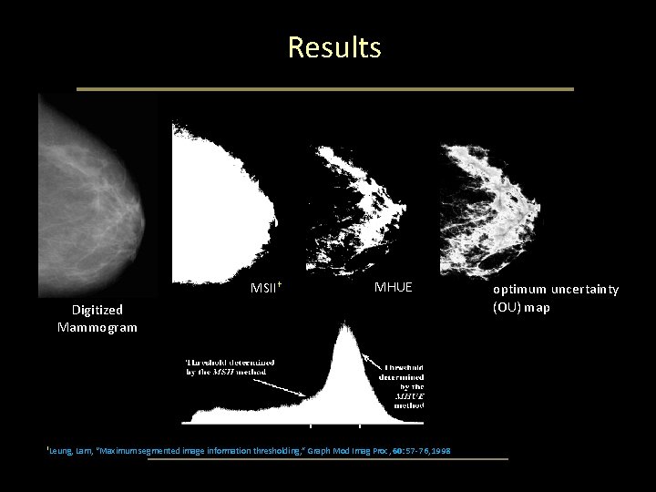 Results MSII† MHUE Digitized Mammogram †Leung, Lam, “Maximum segmented image information thresholding, ” Graph Results MSII† MHUE Digitized Mammogram †Leung, Lam, “Maximum segmented image information thresholding, ” Graph
