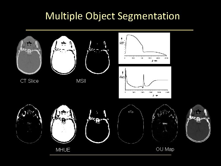 Multiple Object Segmentation CT Slice MSII MHUE OU Map Multiple Object Segmentation CT Slice MSII MHUE OU Map