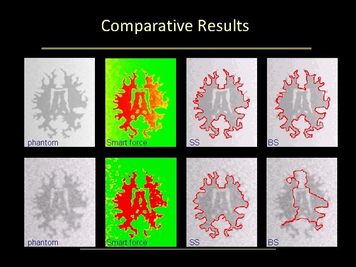 Comparative Results phantom Smart force SS BS Comparative Results phantom Smart force SS BS
