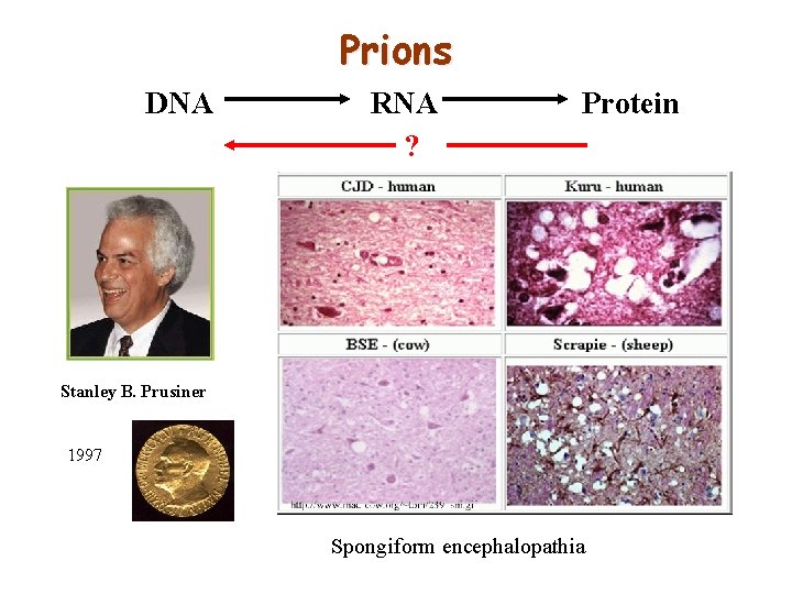 Prions DNA RNA ? Protein Stanley B. Prusiner 1997 Spongiform encephalopathia 